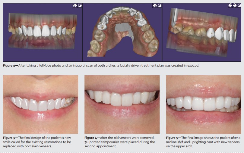 exocad dental cad figure 2 - 5